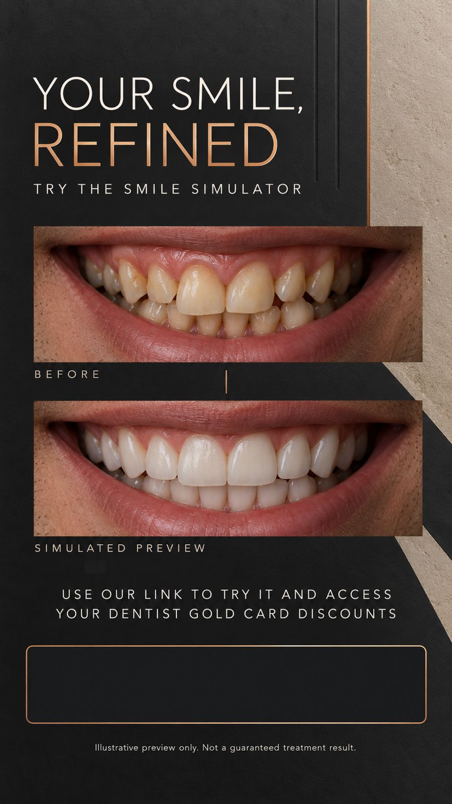 Your Smile, Refined — Smile Simulator Story asset